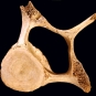 Colour image of a brown bone